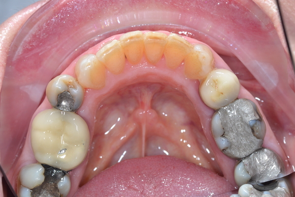 College dental case 2 after