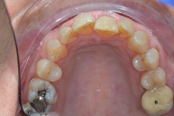 College dental case 5 before