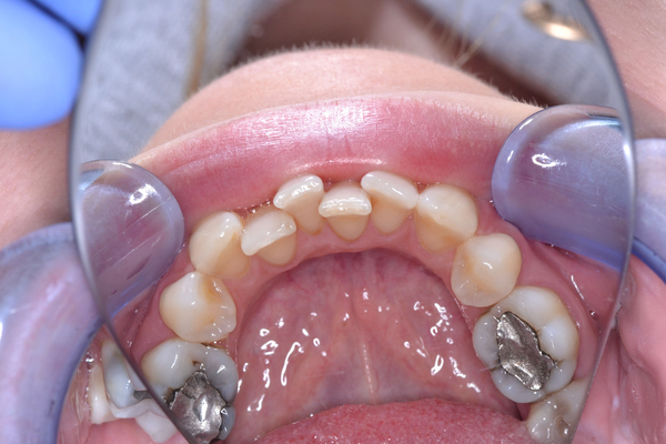 College dental case 6 before