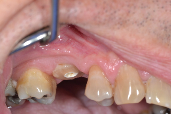 College dental case 7 before