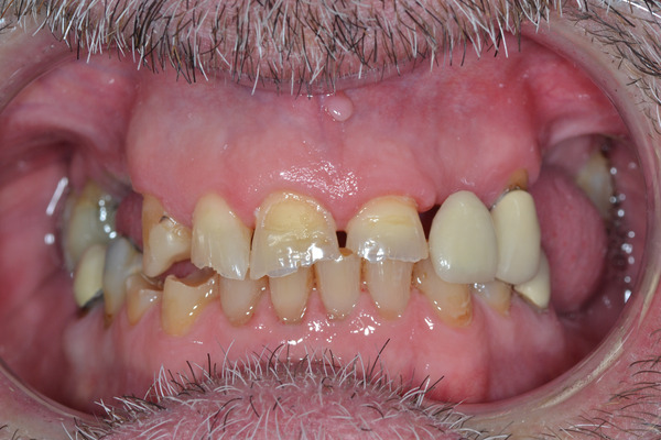 College dental case 8 before