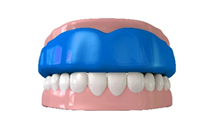 Mouth guards